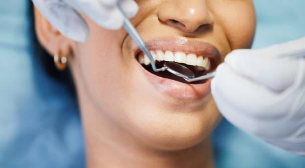 Best Emergency Dental Care for Broken or Chipped Teeth in La Nte, MO