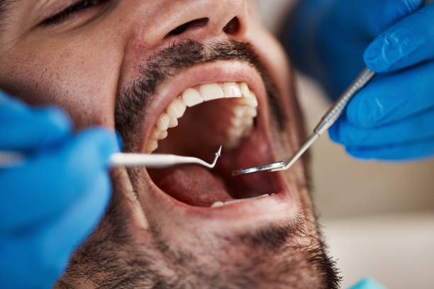 Best Same-Day Emergency Dental Services in La Nte, MO