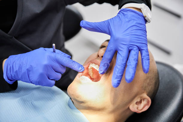 Best Emergency Treatment for Dental Infections or Abscesses in La Nte, MO