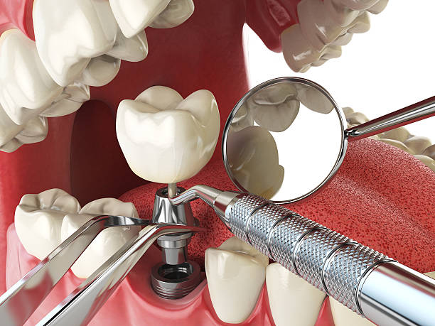 Best Cosmetic Emergency Dentistry in La Nte, MO